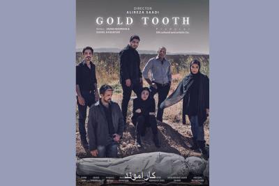 دندان طلا آماده نمایش شد